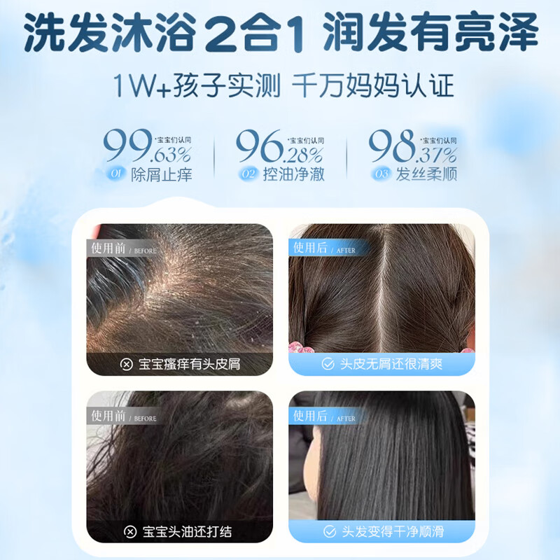 初蔓儿童洗发水沐浴露二合一3-6-12岁婴幼儿宝宝去止痒屑洗护沐浴乳液 【儿童专研】洗发沐浴二合一600ml 冠军推荐儿童洗发沐浴二合一TOP