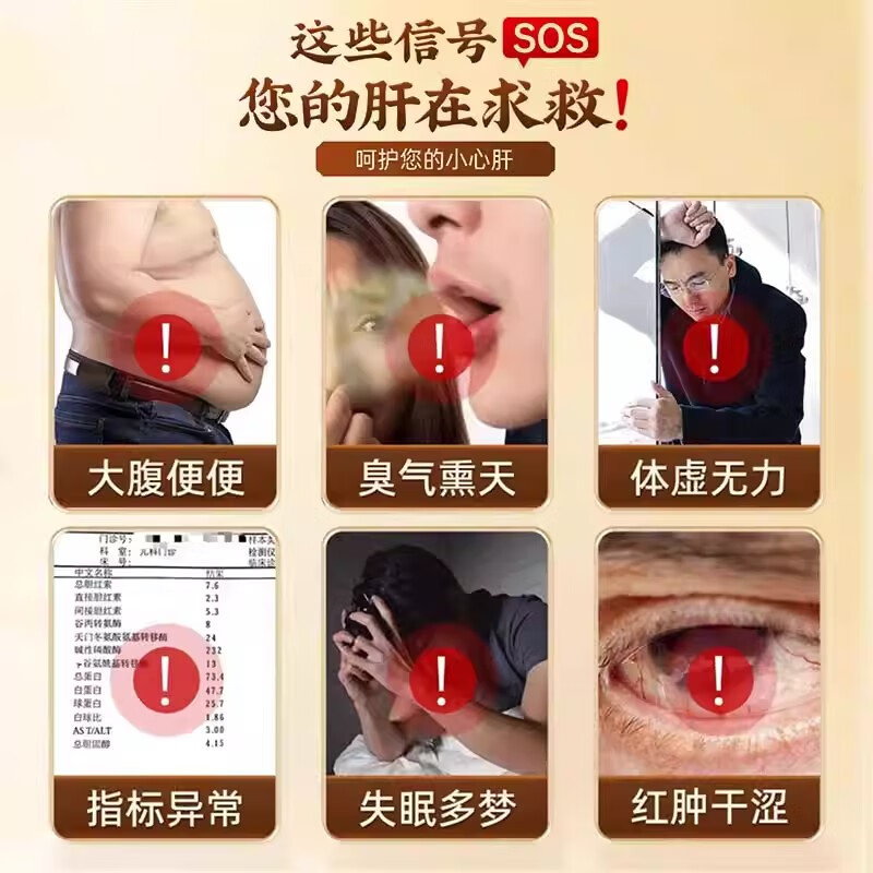 [天佑熊业]熊胆粉 0.3g*10瓶 1盒装 0.3g*10瓶国药准字平肝清热平肝明目目赤肿痛咽喉肿痛熬夜喝酒必备搭养肝护肝片