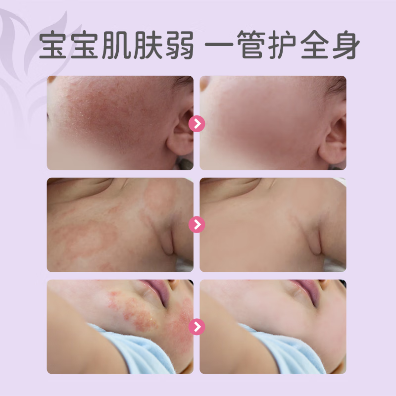 宝莉康柠特护紫草霜婴儿保湿润肤补水霜舒缓泛红面霜 【干痒应急】特护紫草霜50g