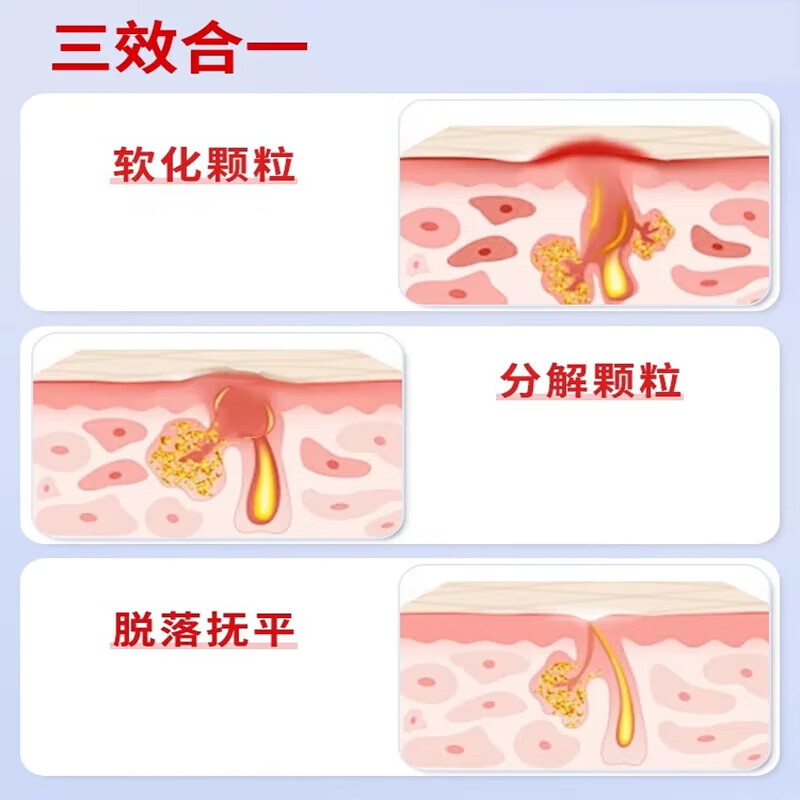 修正脂肪粒去除药膏汗管瘤眼部专用去除神器药眼睛脸上扁平疣油脂粒 单盒装