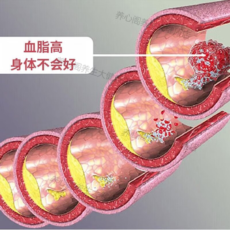 康笑莱圣嘉德纳豆激酶红曲米胶囊疏通软化血管血脂血管清道夫60粒/瓶 3瓶周期装