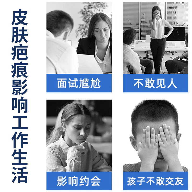葵花疤痕增生凸起痒去除疙瘩去疤痕修复凝胶医院专用祛疤膏除新旧疤痕 1盒【3cm小疤】轻松修复