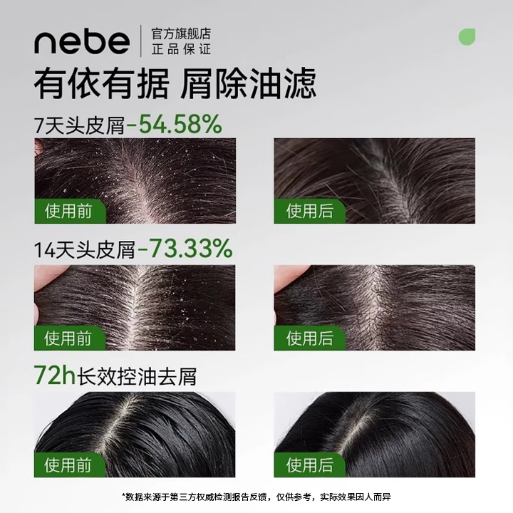 Nebe去屑洗发水香氛控油清爽蓬松柔顺洁净油污留香男女洗头膏正品NEBE 【去屑留香】洗发水300ml