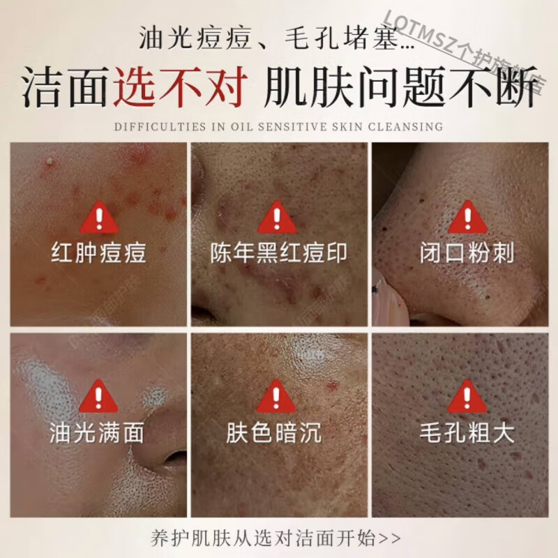 LQTMSZ硫磺洗面奶控油祛痘除螨虫去黑头粉刺收缩毛孔男女专用旗舰店正品 一瓶装