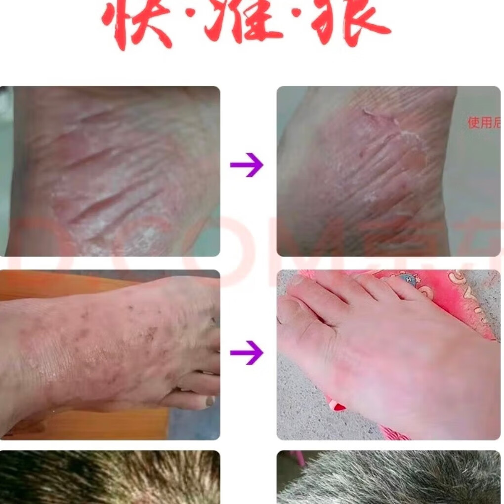 紫花地丁江西康御堂透皮抑菌膏皮肤瘙痒杀菌私处止痒脚气真菌草本乳膏外用 金装28克顺丰当天发货(送试用装)