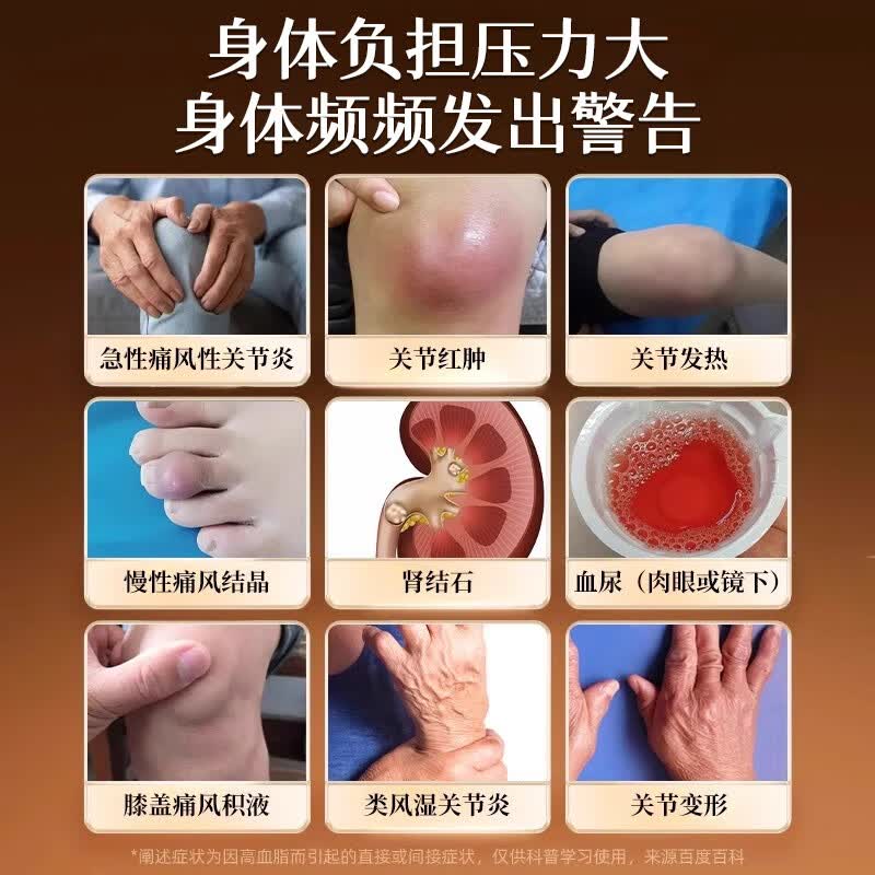 三井制药三井晶清固锭胶囊風酸溶石去结晶关节红肿缓解疼痛酸風高溶石 3盒装 24粒*3瓶