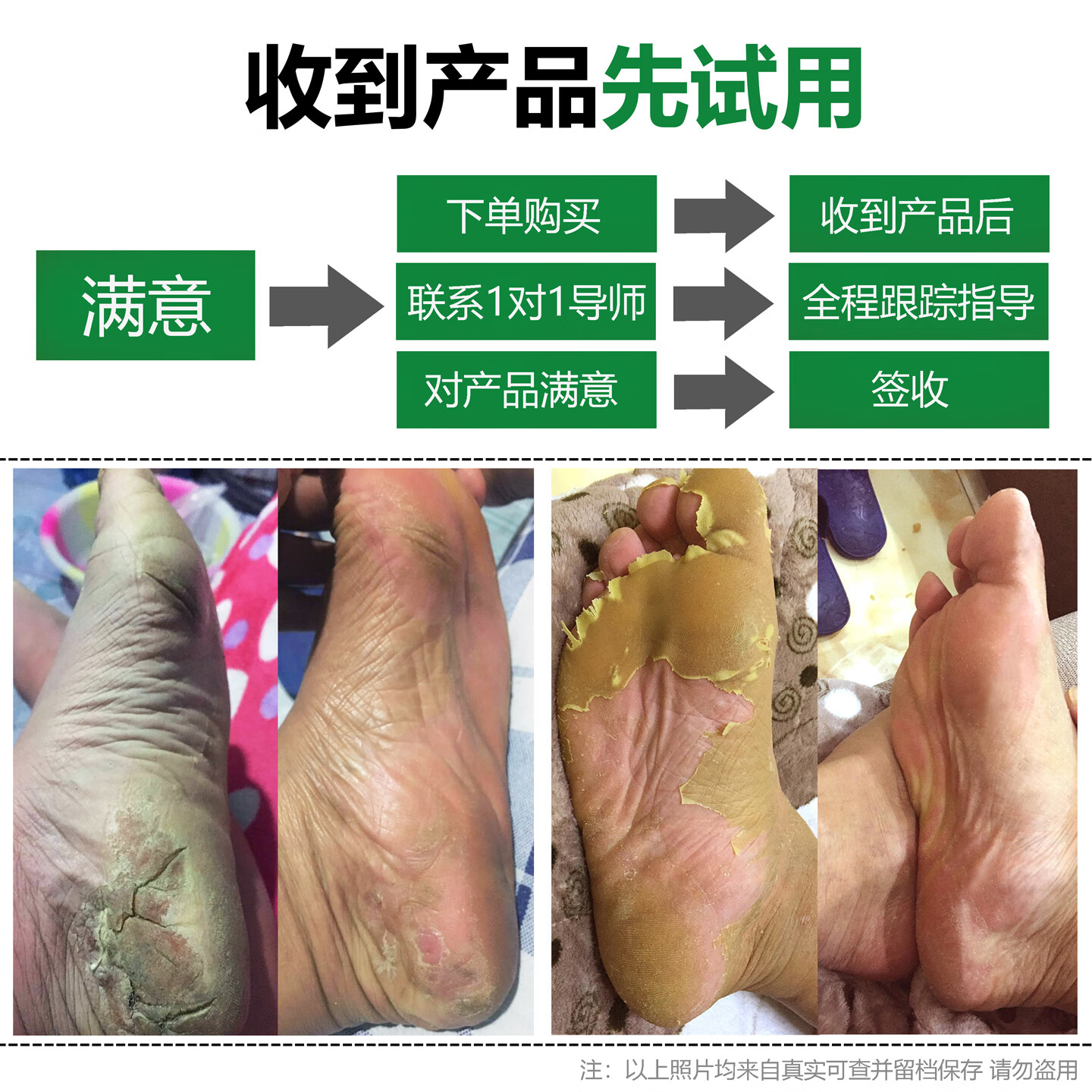 润芷堂脚气泡脚【泡1次】洁丫本草 足浴包脱皮水泡脚痒烂脚丫汗脚臭喷剂 轻度中度用1次