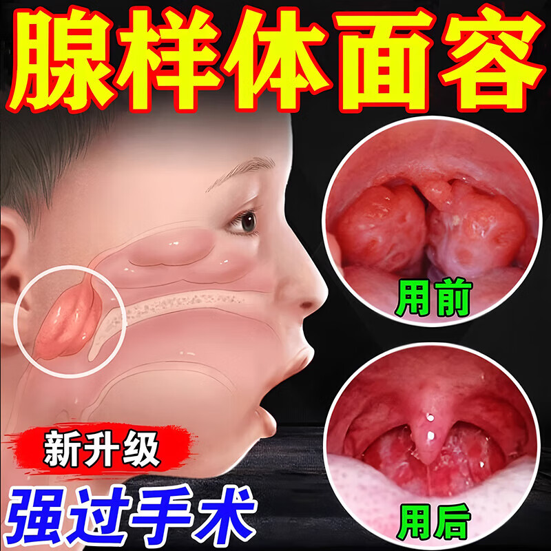 【中药枕】腺样体肥大通鼻塞炎枕头面容扁张嘴睡觉儿童成人调理枕 【108味中草药】 告别腺样体肥大 京东折扣/优惠券