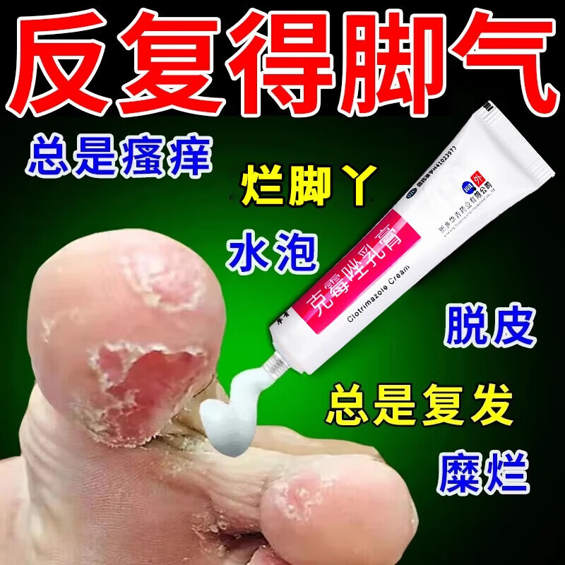 恒久远脚气药膏止痒脱皮烂脚丫真菌感染专用药正品治脚气脚臭的药烂脚起小水泡皮肤用药克霉唑乳膏去看脚缝根痒得治 一盒装【推荐组合装快速治疗】