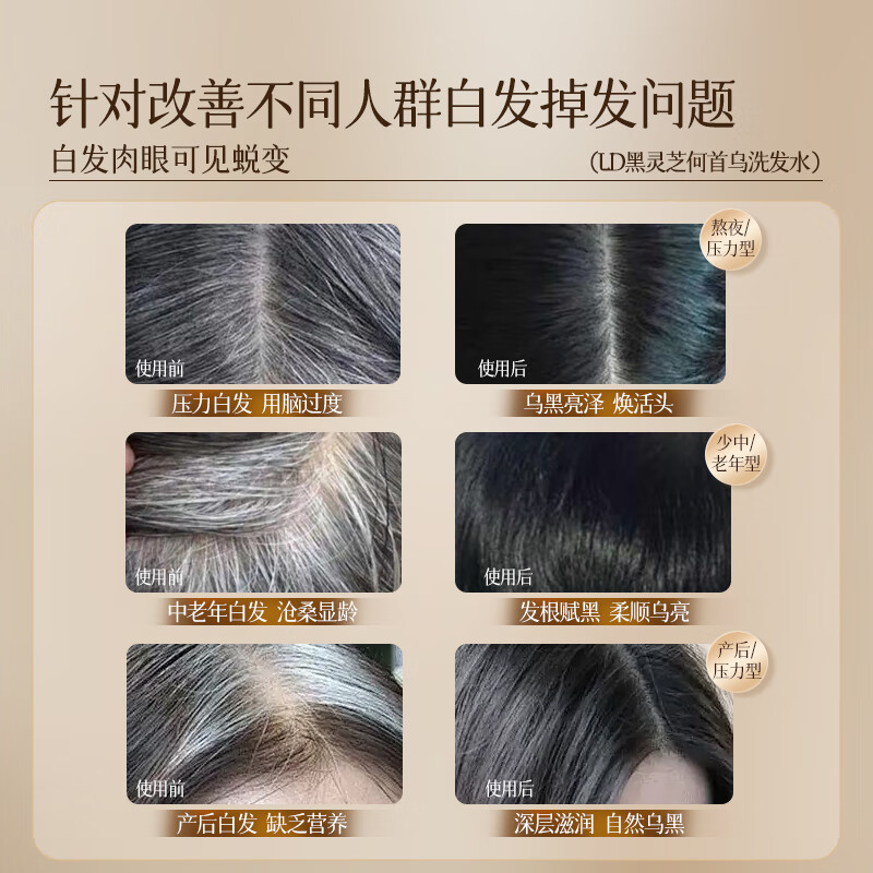 LD何首乌洗发水白头转黑乌黑白发发根变黑发治正品根黑灵芝金榜第1