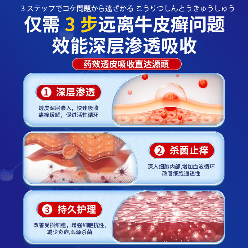 岩井昃弘牛皮癣100%专用的药膏真菌止痒抑菌皮肤顽固牛皮癣银屑病进口膏药 特效1盒【专攻牛皮癣】当晚消除 牛皮癣生物制剂 真菌王