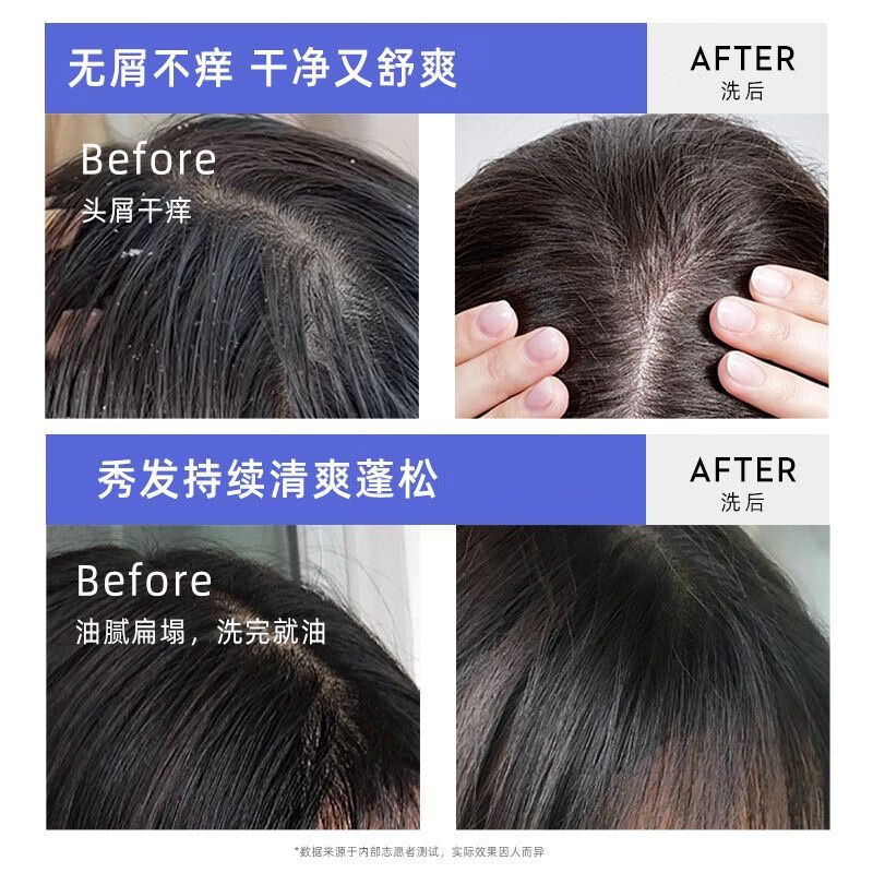 采乐二硫化硒洗发水去屑止痒洗发水清爽蓬松控油洗发水溢脂性洗发乳男 【双重去屑】二硫化晒420ml*2瓶