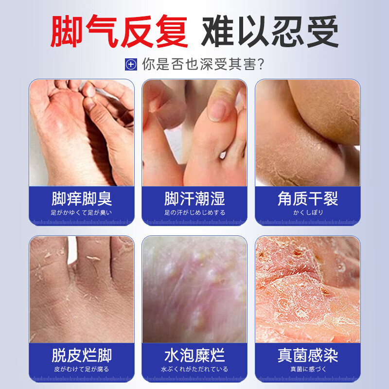 葛幸药房脚气喷剂止痒脱皮烂脚丫真菌感染脚汗水泡杀菌祛臭喷雾 脚臭祛味喷剂1盒装【杀菌止痒】