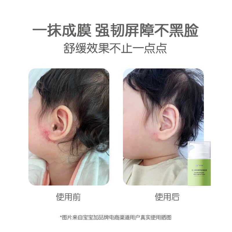 宝宝加婴幼儿高保湿面霜春夏四季儿童滋润保湿裸藻精萃舒缓面霜 【单支装】高保湿面霜50g