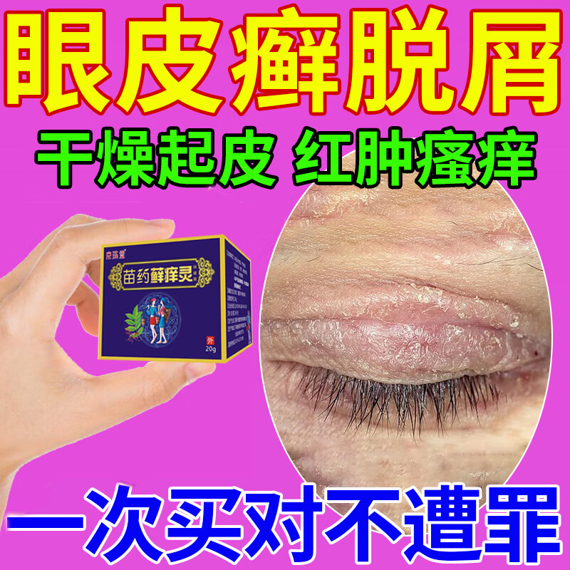 眼皮上长癣用什么药膏图片