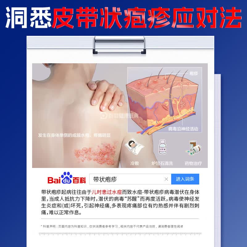 本桑制药带状疱疹后遗症神经痛膏断根蛇盘疮线性单纯性疱疹蛇胆疮专用膏 2盒周期套餐【只要1盒价】