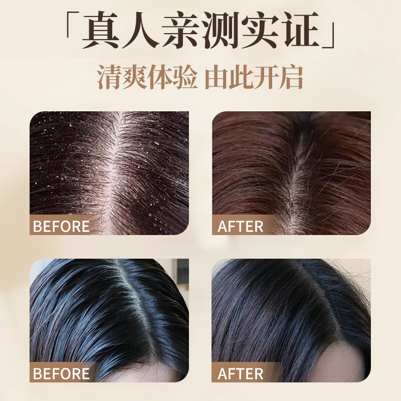 霸王洗发水生姜控油蓬松洗发露去屑止痒洗头膏男女士清爽亮泽洗发液 468ml生姜控油洗发水