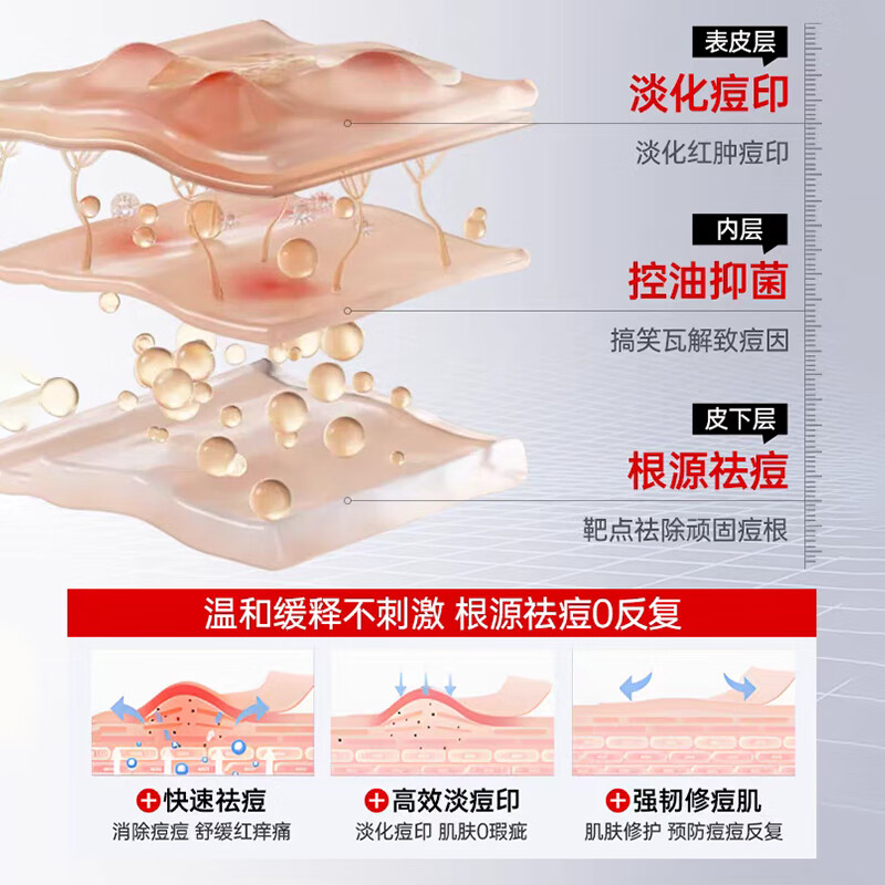 美人符水杨酸祛痘面膜补水保湿淡化痘印熬夜急救收缩毛孔舒缓男女士专用 10片 一盒装【控油舒缓补水】