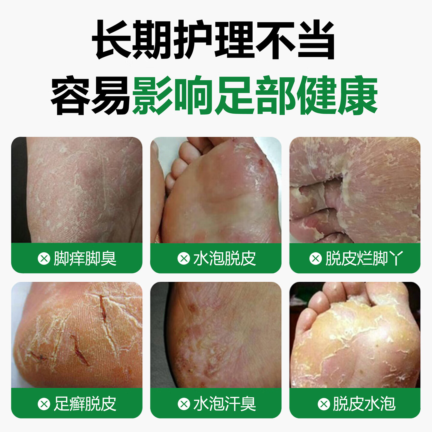 润芷堂脚气泡脚【泡1次】脚气足浴包脱皮水泡脚痒烂脚丫脚汗脚臭喷雾剂 严重 重度 用3次