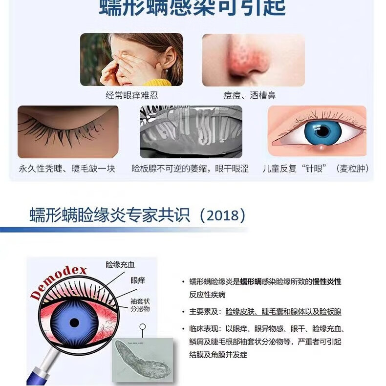 眼医生眼小医4-松油醇老款除螨棉片百分之一浓度纳米制剂小分子深度除螨 30片装