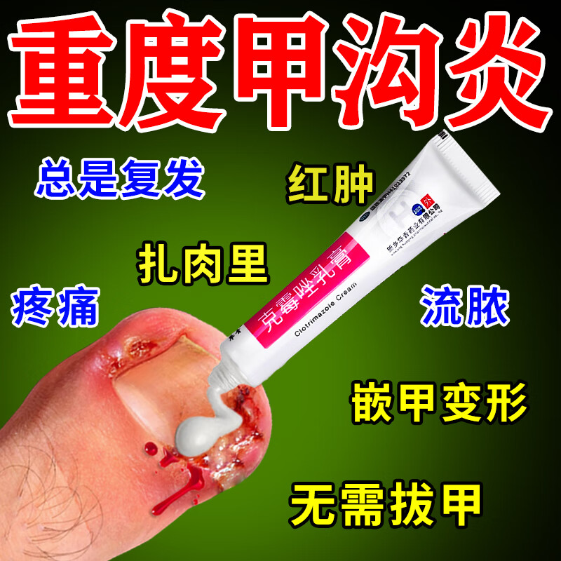 [华青]克霉唑乳膏 10g 1盒装 甲沟炎专用去药根部治脚趾甲往肉里长消肿止痛去肉芽治严重息肉外用消炎药【视觉特效】