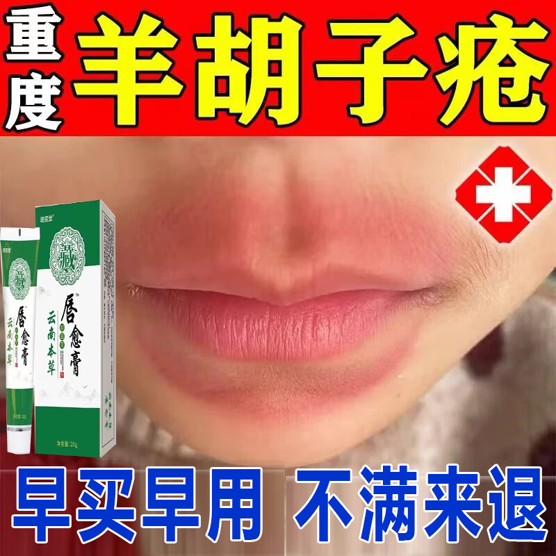 羊胡子疮专用小孩舔嘴唇周膏婴儿口水疹宝宝下巴发红无激素慢性唇炎