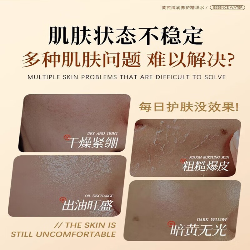 琪瑟胖I东来黄芪爽肤水祛黄提亮肤色补水保湿抗皱紧致抗衰老敏感肌女 1大瓶500ml【黄芪养护精华水】
