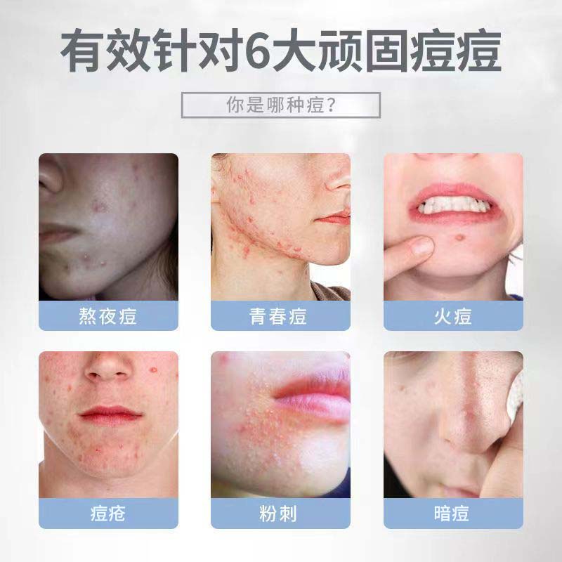 修正【痘痘凝胶】丹参植物祛痘凝胶透明清爽脸上痘头上痘胸背痘男女痘 2支【丹参祛痘凝胶】 20克/支