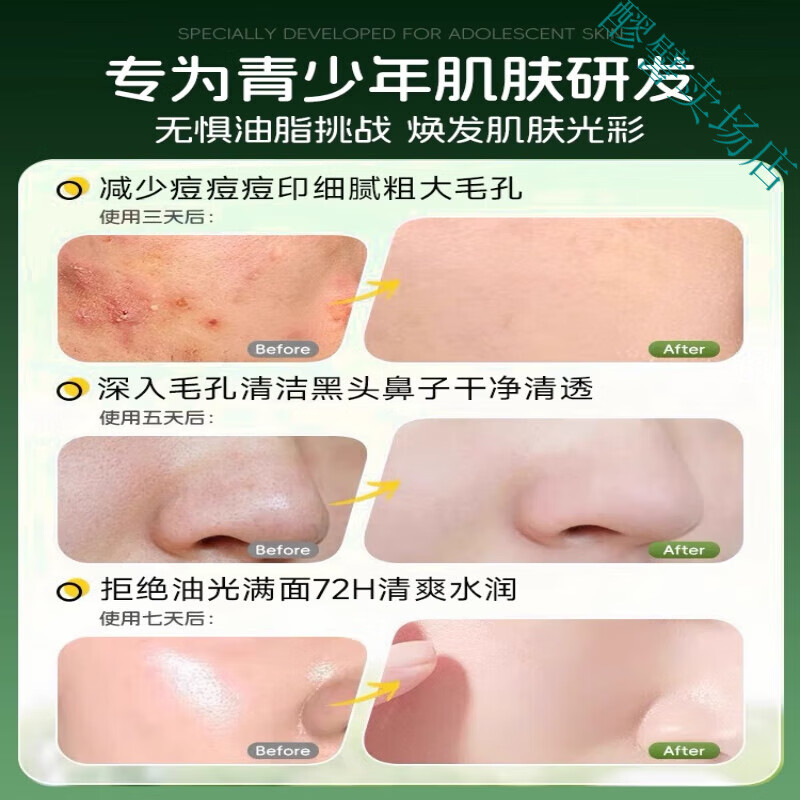 MRYU云漫密洗面奶水杨酸祛痘印粉刺黑头控油青少年洗面奶洁面氨基酸
清肌控油祛痘*1