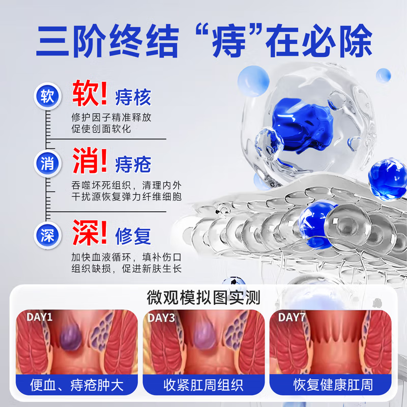 DR.ADDO痔疮膏去肉球内外混合痔疮专用特痔疮药卡波姆痔疮凝胶去肉球断根 1盒体验装【肛周瘙痒/轻微疼痛】100%特药 痔疮凝胶100%特专用的药京栋自蓥旗舰店痔疮药栓