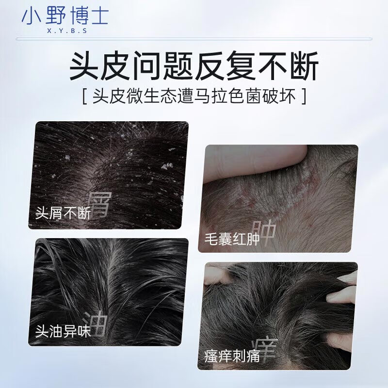小野博士二硫化硒洗发水去屑止痒控油持久蓬松毛洗发水控油男士女士通用 一瓶体验装【根净油屑】200ml