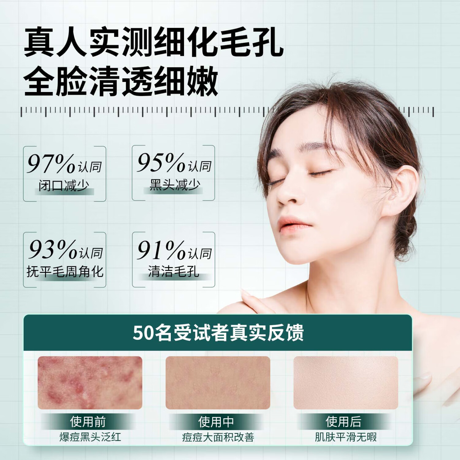 UOCC面膜细腻毛孔控油保湿水杨酸清洁肌肤痘痘闭口绿罐减黑头 两件装