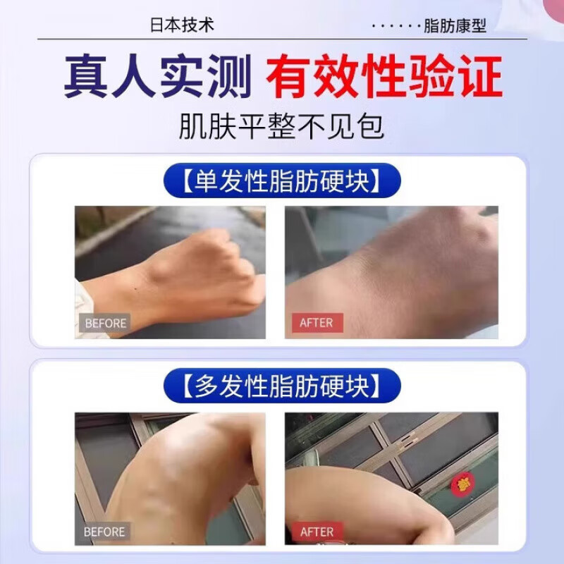 保元医生祛疣膏葆远红外凝胶治疗脂肪瘤医用β葡聚糖皮肤敷料凝胶 3盒装[80%客户选]