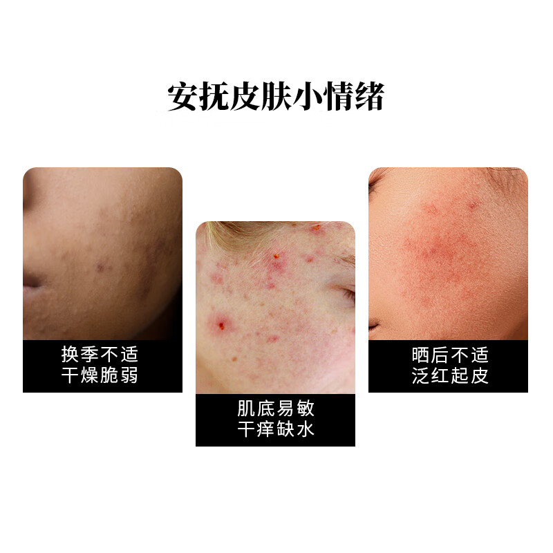 芳香世家罗马洋甘菊美肤精华油+罗马洋甘菊纯露套装 温和护肤修护敏感肌 洋甘菊精油10ml+洋甘菊纯露100ml