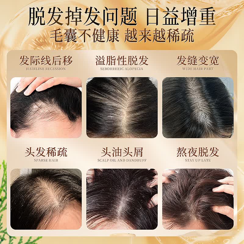 贺澧中药草本精华洗发水育发液防断发滋润蓬松强韧贺澧植物洗发液 防断护发洗发水500ML*2瓶
