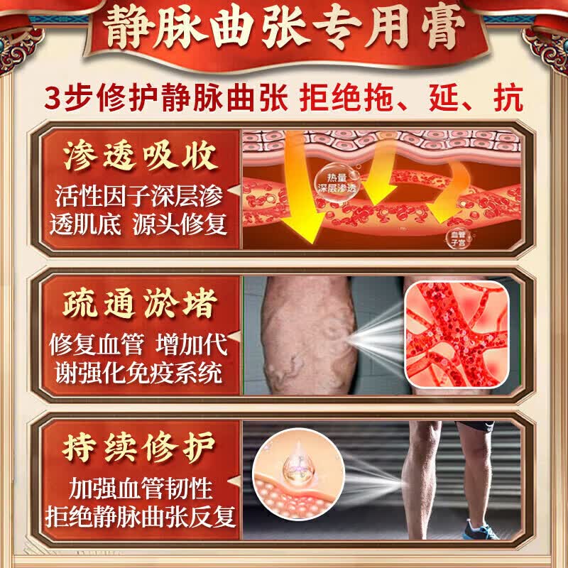 北京协和医学院静脉曲张专用膏药蚯蚓腿疏通血管堵塞进口药冷敷凝胶治疗静脉舒膏 特效1盒【静脉曲张专用】 特效静脉曲张喷雾专用贴的