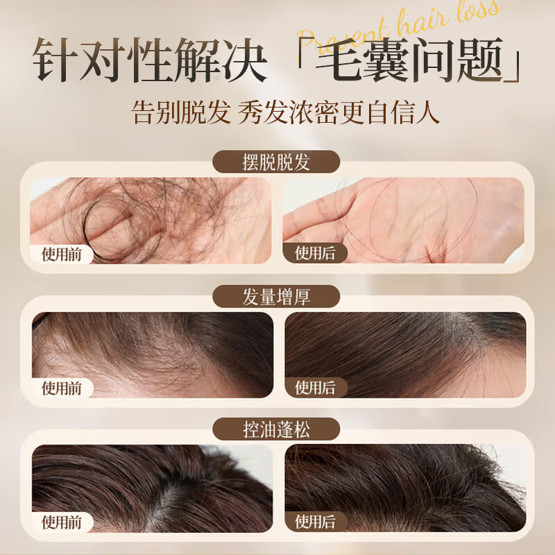 聚容防脱育发洗发水生姜侧柏叶固发控油植物萃取防脱洗发水去屑止痒 防脱密发洗发露（植物萃取） 500ml*2瓶（周期护理）