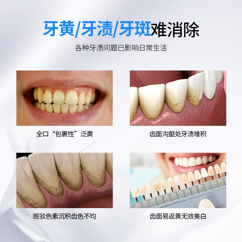 可立克去牙渍蜂毒牙膏薄荷味亮白去黄去烟渍除口腔异味清新口气呵护牙龈 【3支装】去牙渍105g*3支