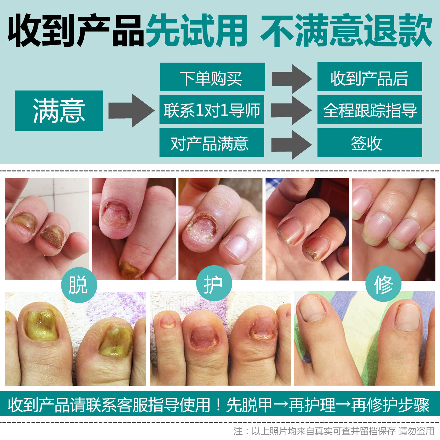 润芷堂灰指甲专用套装【30天可退】甲增厚变白甲萎缩分层甲沟炎凹凸不平  脱甲金油+抑菌液（1+2号液）