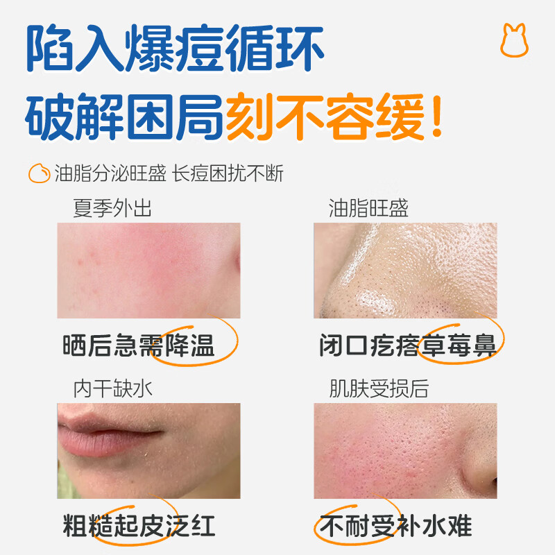 袋鼠杰克青少年儿童控油清痘洗面奶男孩女孩儿童补水抗痘水乳精华面霜面膜 【修护肌肤屏障】青少年补水面霜*1