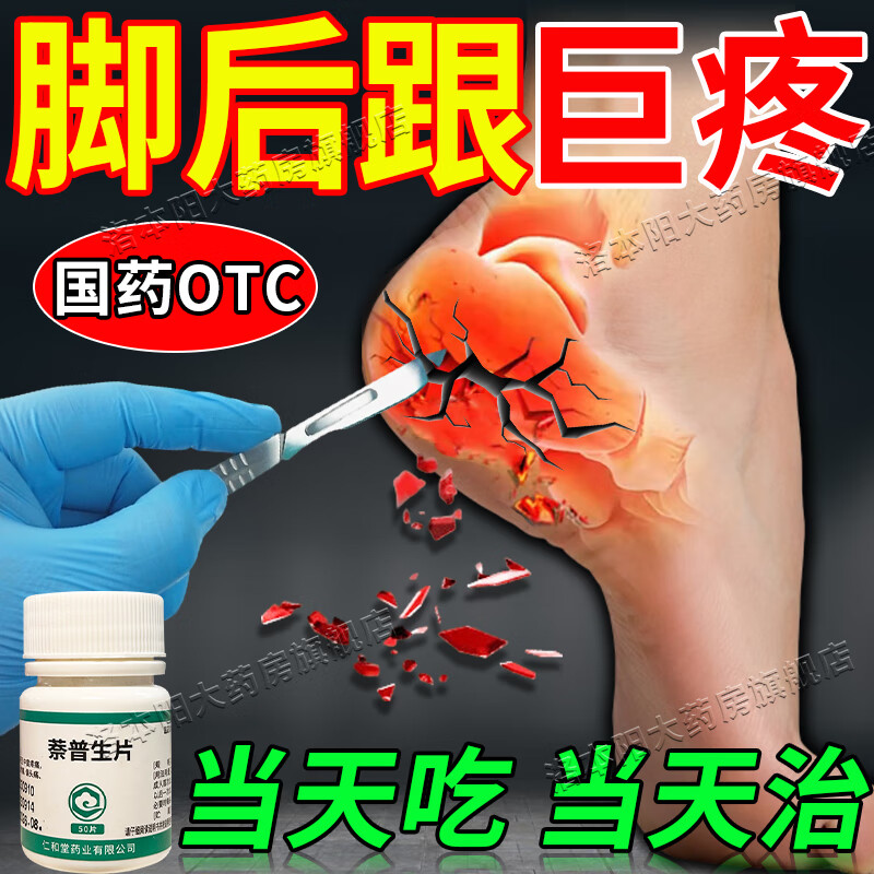 足跟痛脚后跟疼痛专用特新效期药足底筋膜炎专用药足跟骨刺跟腱炎筋膜炎肿胀疼痛 止痛镇痛药 萘普生片 1瓶【脚后跟疼痛】 足跟痛专用药脚后跟疼痛特新效期专用药