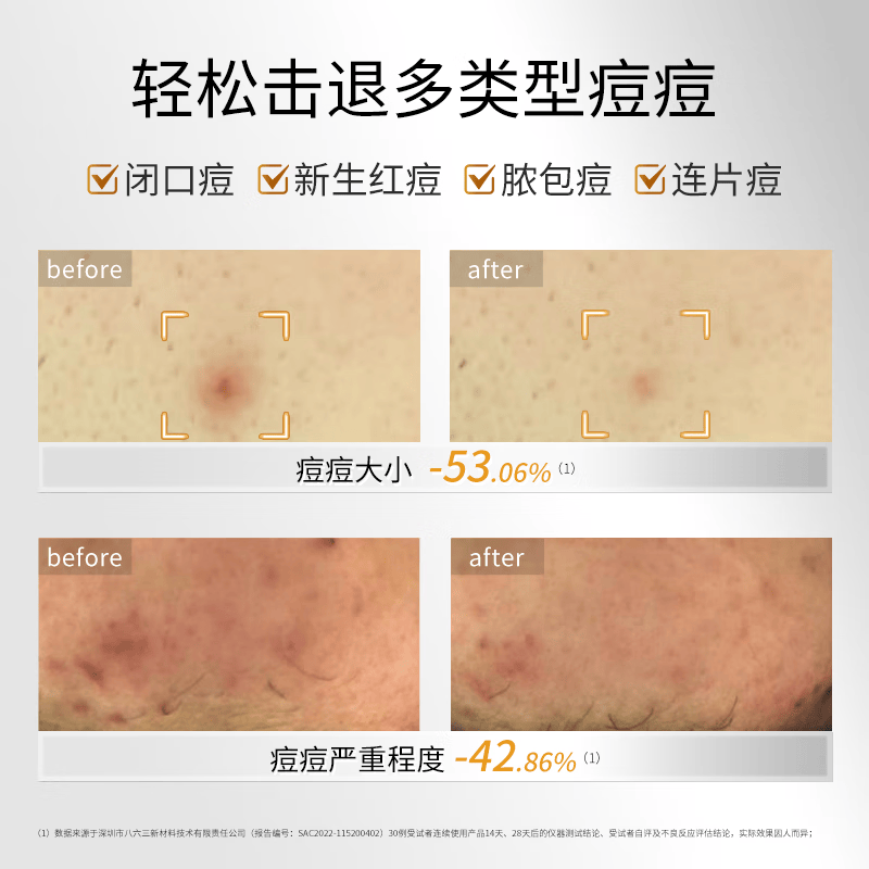 敷尔佳[新品上市]乳糖酸控油敛肤面膜 净油光 敛毛孔 控油祛痘紧致肌肤  乳糖酸3盒