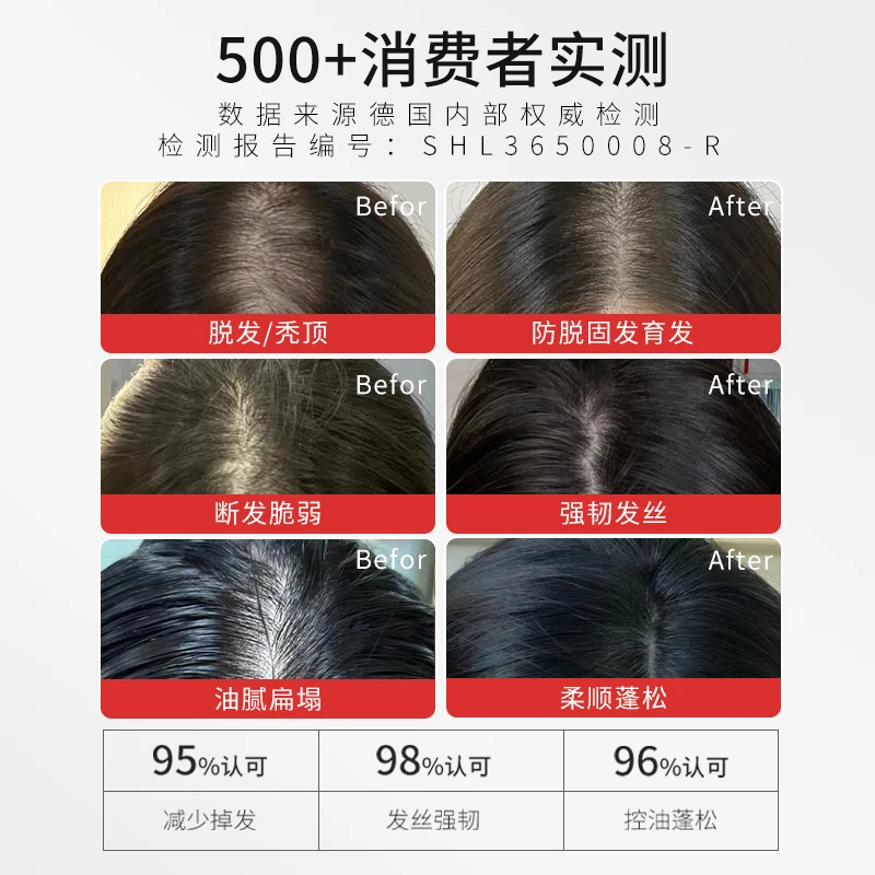 Exitans咖啡因3.3%防脱洗发水男女强韧固发控油去屑止痒洗发露洗头膏 1瓶【咖啡因防脱洗发水250ml】