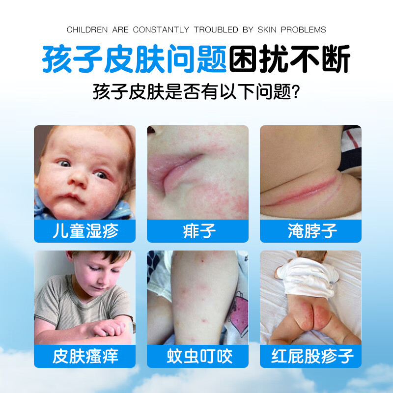 GEKX医用湿疹止痒膏婴幼儿专用宝宝儿童身体乳口水疹无激素皮炎瘙痒 1盒装 100ml【贵在运费 不推荐】