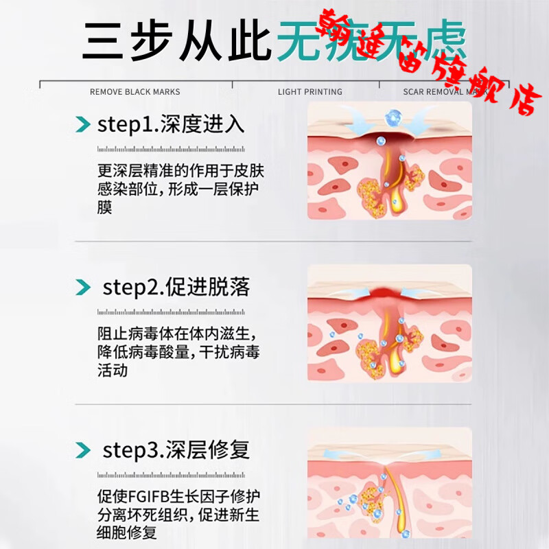 五妙水仙乳膏国药准字号扁平i疣专用膏去i疣瘊小肉粒其他身体护理 3盒周期装【适用中度症状】买2送1 【官方授权】