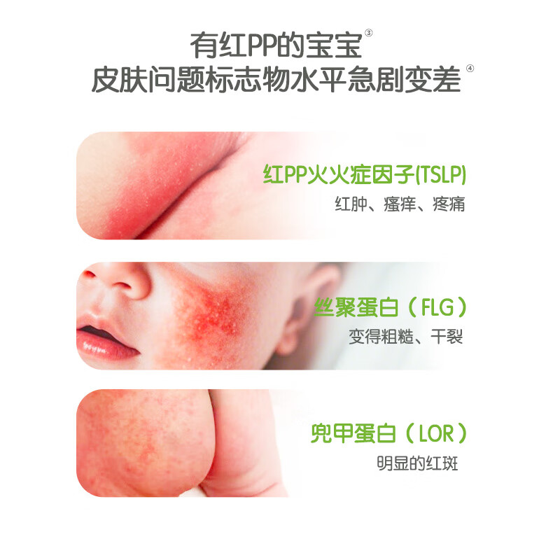 宝宝加裸藻护臀膏红屁屁淹脖子苹果脸新生婴儿多效护理膏央视严选 天然高效护理膏-轻松护臀干红痒