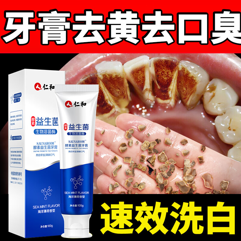 胖东来牙膏亮白护齿牙膏清洁牙渍牙垢去口臭牙黄垢斑异味清新口腔 2支装中度牙结石