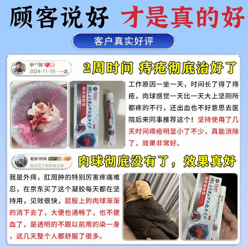岩井昃弘痔疮凝胶100%特傚效专用膏药去i肉球内外混合痔疮去i肉球根断消痔 1支装【内外痔专用膏药】日本断痔膏