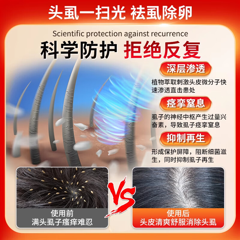 虱子药儿童头虱虱卵一扫光百部酊去头虱小女孩头发去除虱卵虱立净 1盒【60ml】一喷去虱