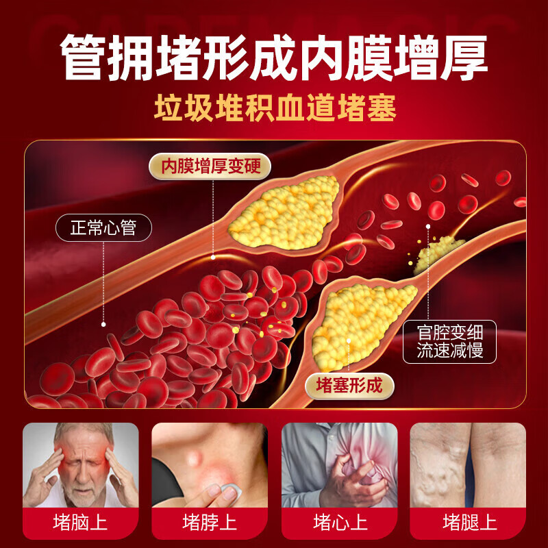 ISDG进口纳豆激酶胶囊降血脂血压溶栓疏通心脑血管1顶3瓶营养保健品 纳豆量贩装【3个月】 180粒*1瓶
